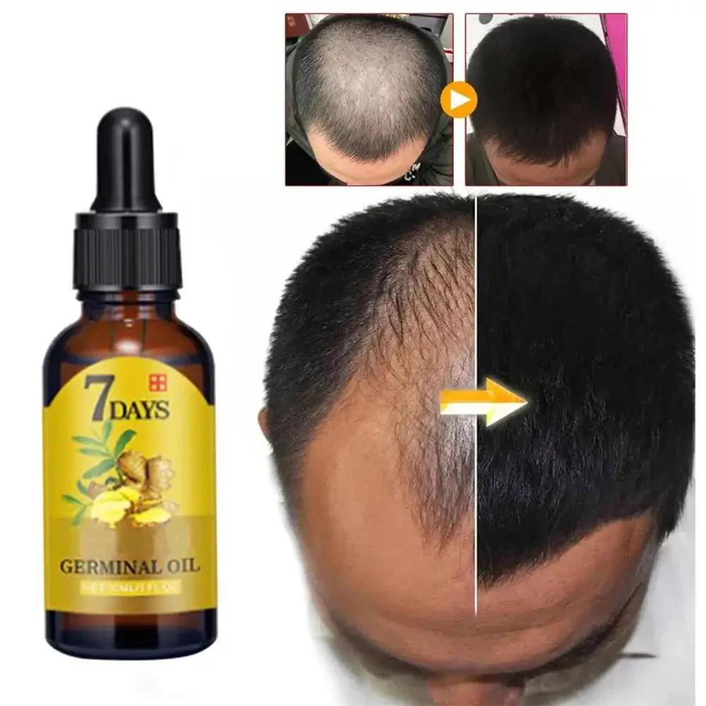 Hair Care Fragrance Essential Oil - Aceite esencial de jengibre para el