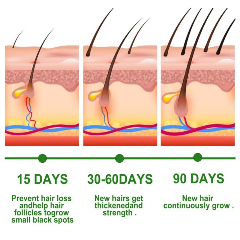 Suero para el crecimiento del  - Hair Care Fragrance Essential Oil reseña y precio