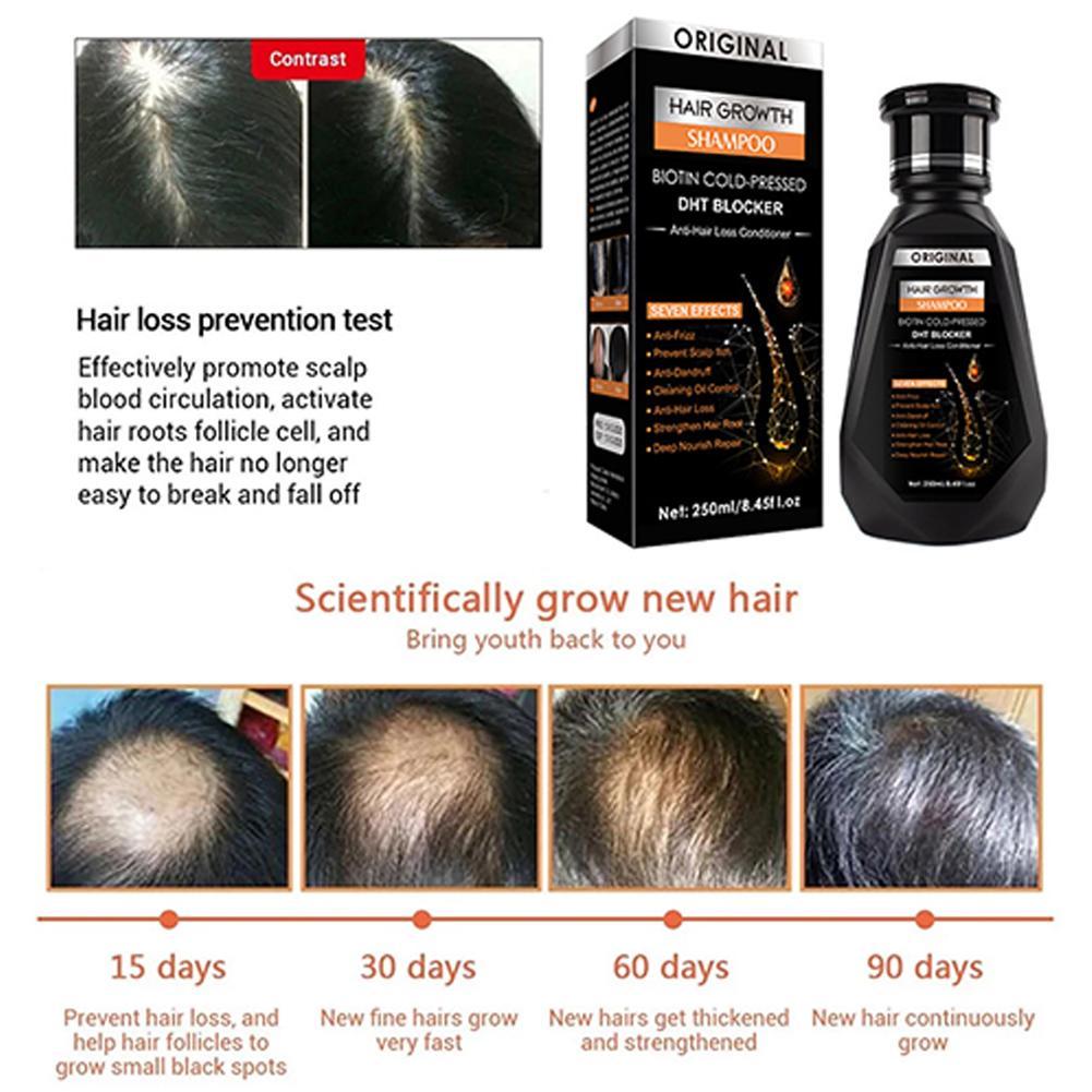 Champú de biotina y jengibre,  - Biotin Shampoo Thickening reseña y precio