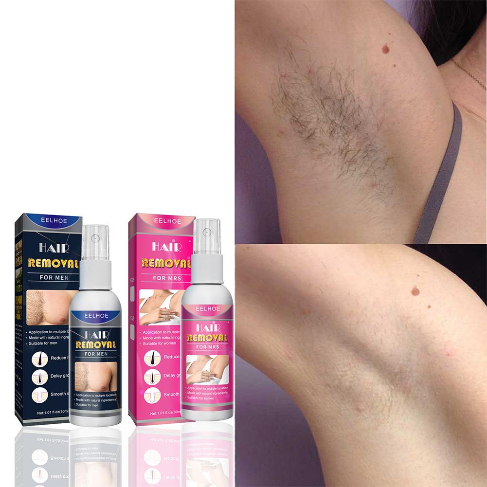 1/2 Uds. Depiladora permanente - Hair Care China reseña y precio