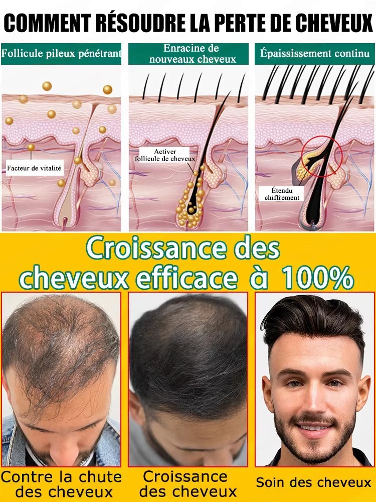 Cuidado Diario del Cuero Cabel - Hair Care Step reseña y precio