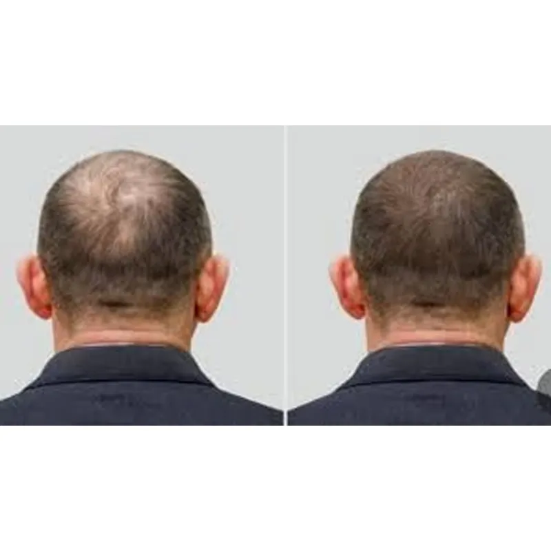 Gorro de Ozono Good Seal para  - Hair Care Good Hair reseña y precio
